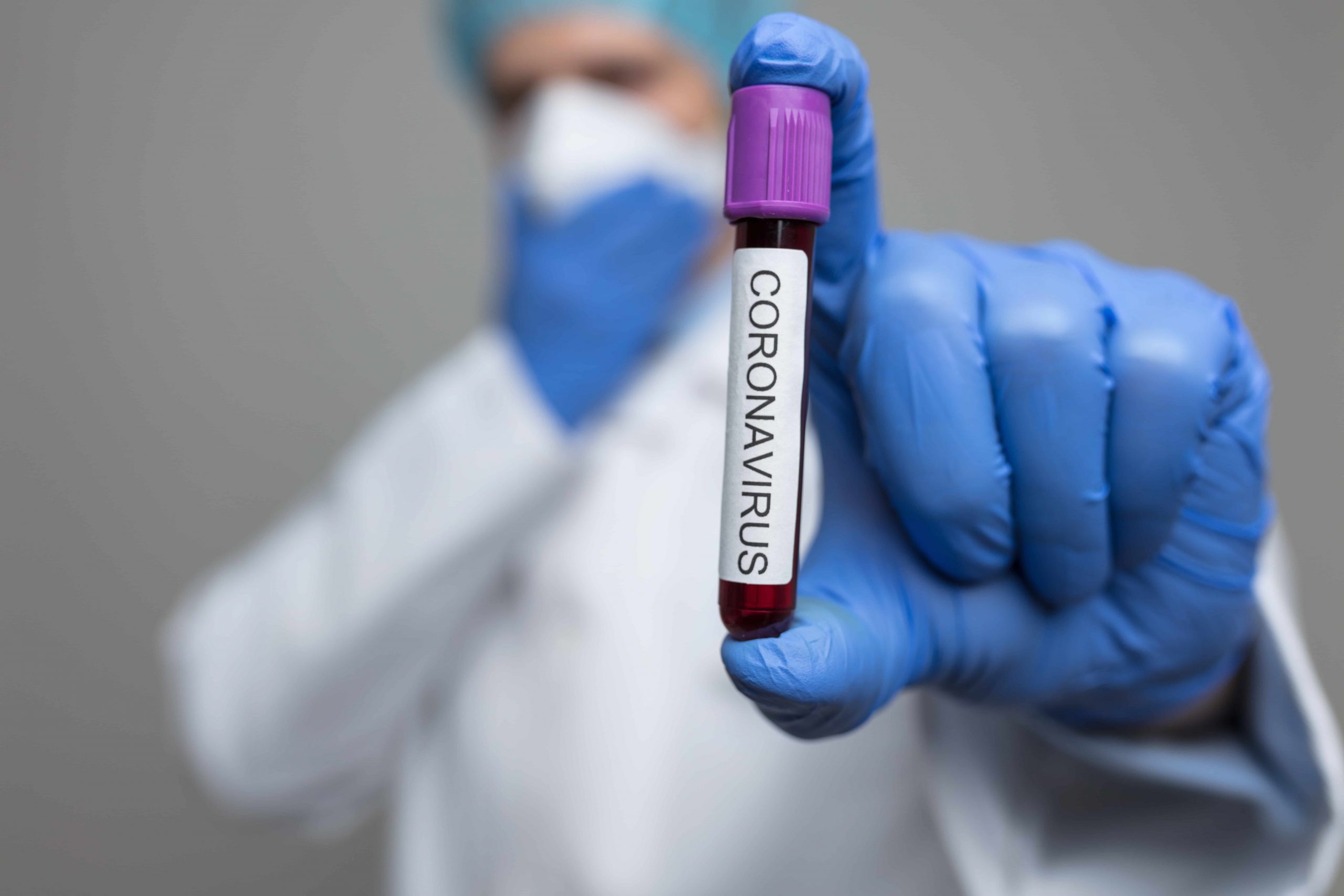Coronavirus Will Deter Third Of Buyers And Sellers